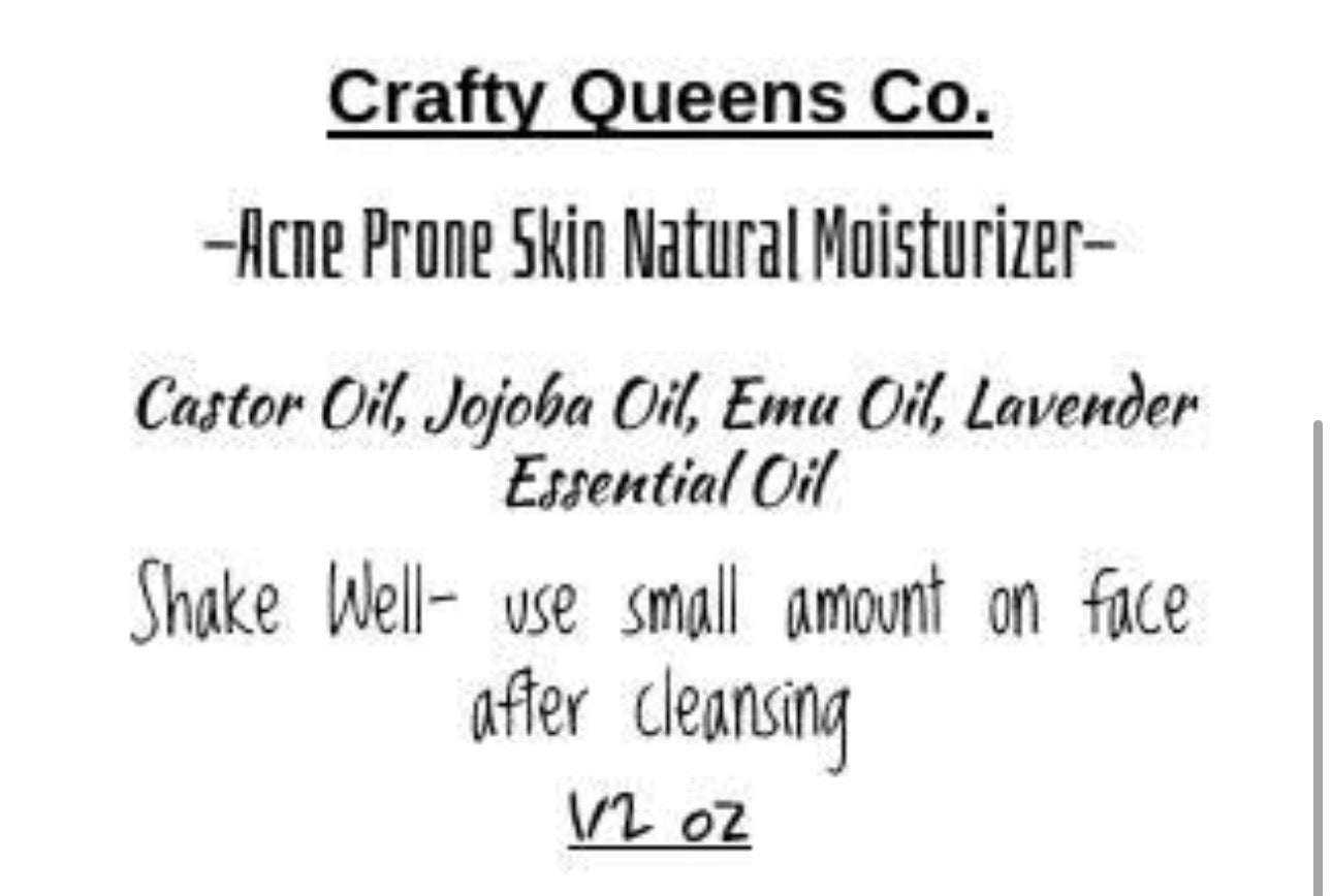 Acne Prone Skin Natural Moisturizer